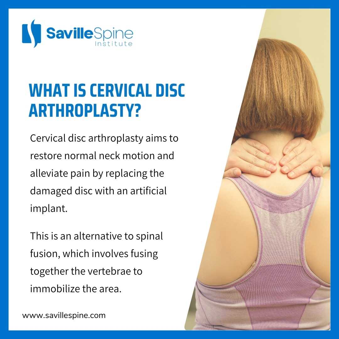 How Long Does It Take to Recover from Cervical Disc Arthroplasty?