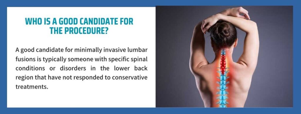 1767995616_Minimally-Invasive-Lumbar-Fusions-2 minimally invasive lumbar fusions